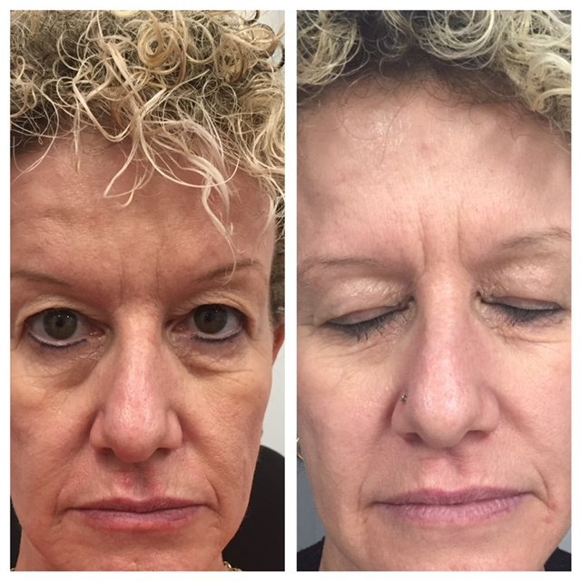 About Face Laser & Cosmedic Clinic - About Face Laser & Cosmedic Clinic