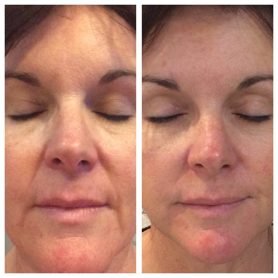 About Face Laser & Cosmedic Clinic - About Face Laser & Cosmedic Clinic