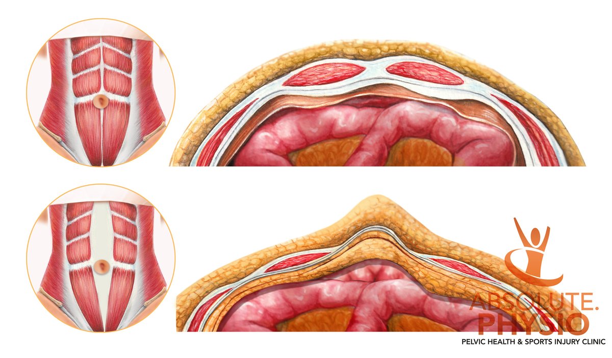ABSolute-Physio - ABSolute-Physio