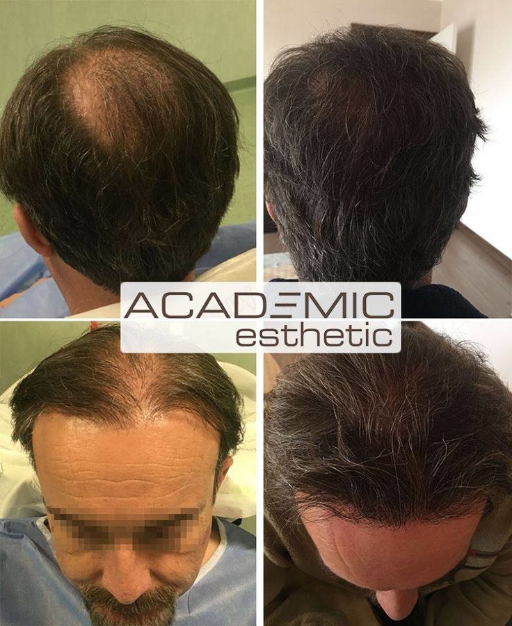 Academic Esthetic - Academic Esthetic