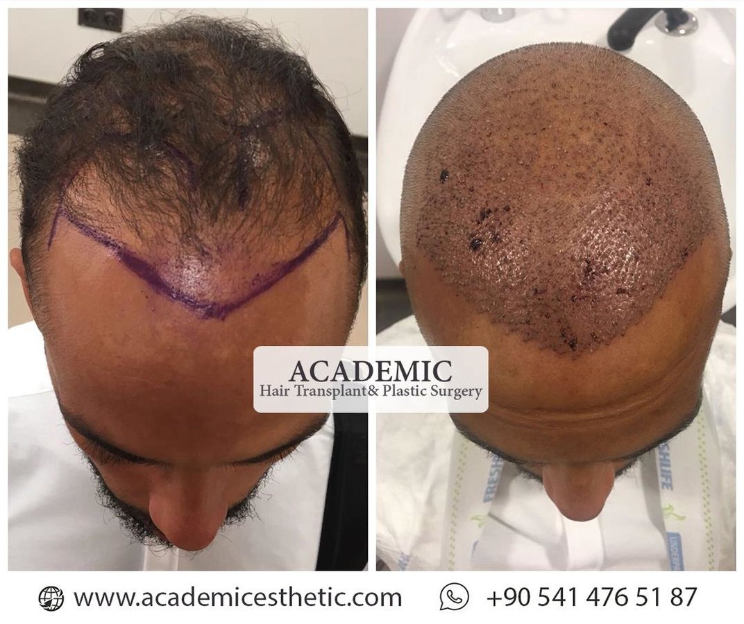 Academic Esthetic - Academic Esthetic