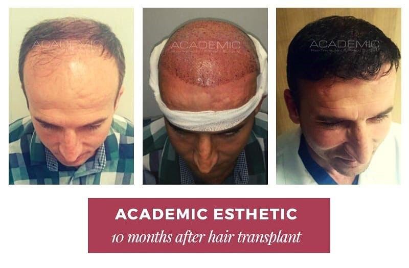 Academic Esthetic - Academic Esthetic