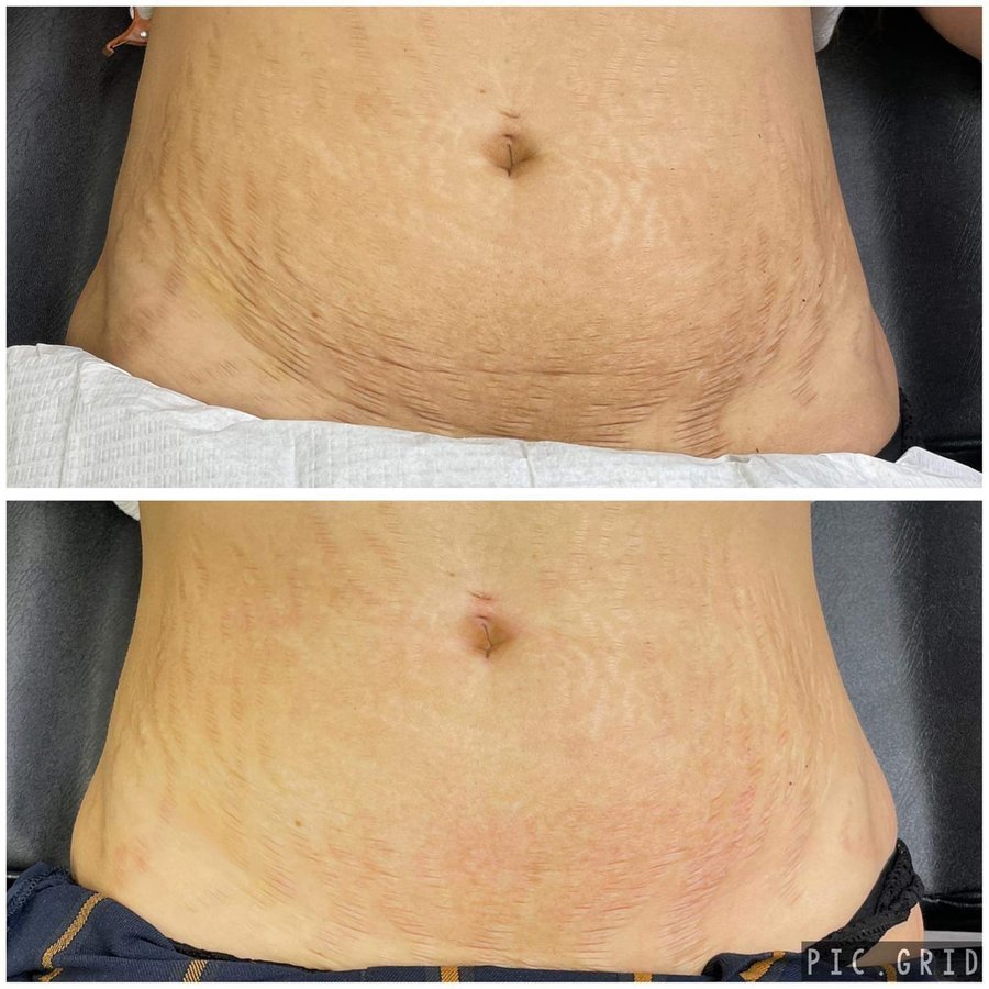 Acars Clinic - Acars Clinic