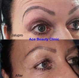 Ace Beauty Clinic - Ace Beauty Clinic