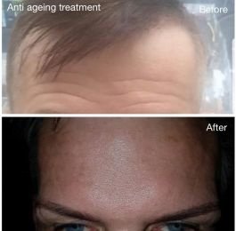 Ace Beauty Clinic - Ace Beauty Clinic