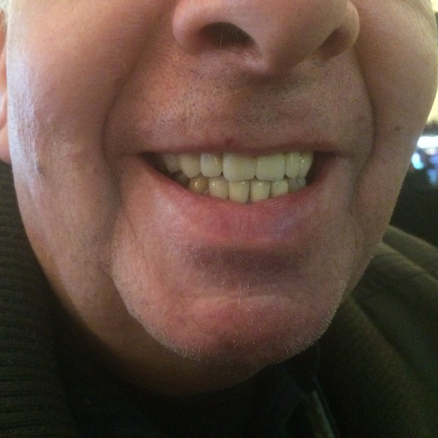 Activ Dental - Activ Dental