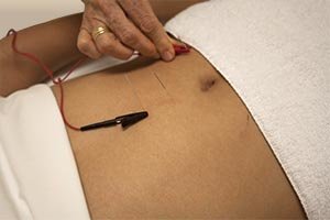 Acupuncture & Homeopathy Center - Acupuncture & Homeopathy Center