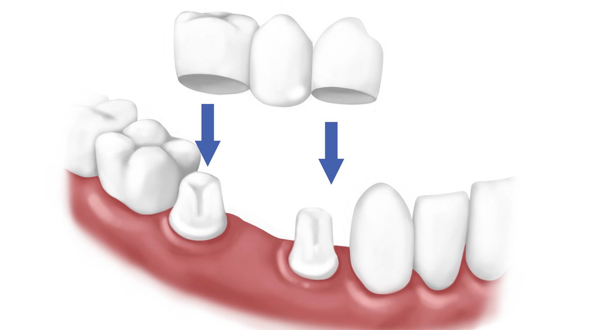 عيادة طب الأسنان أدارش - Adarsh dental Clinic