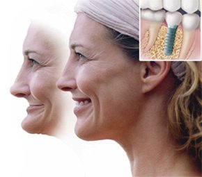 عيادة طب الأسنان أدارش - Adarsh dental Clinic