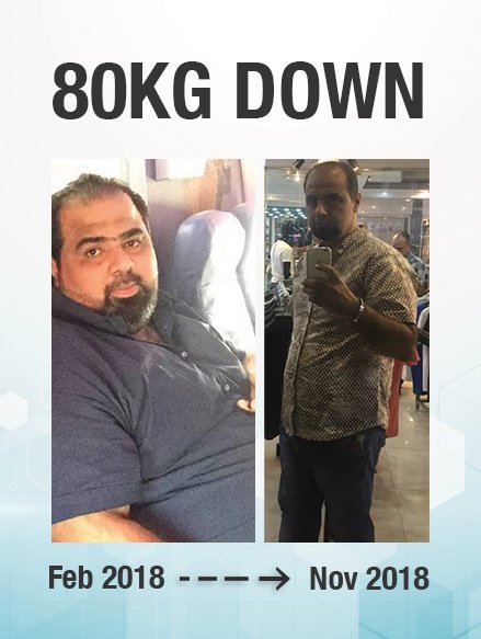 Advanced BMI - Dr Nagi Jean Safa - Advanced BMI - Dr Nagi Jean Safa