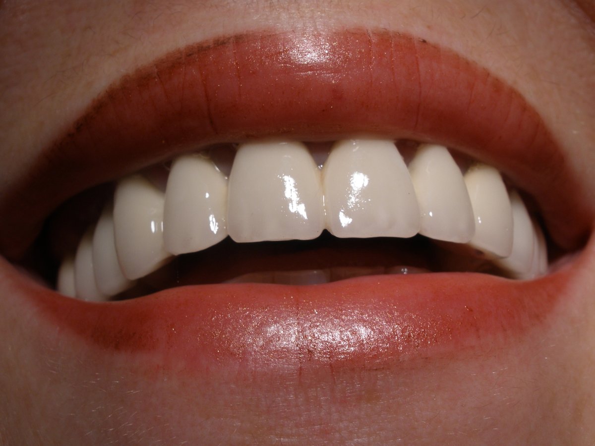 Advanced Dental Clinics Dr.Sacco - Advanced Dental Clinics Dr.Sacco