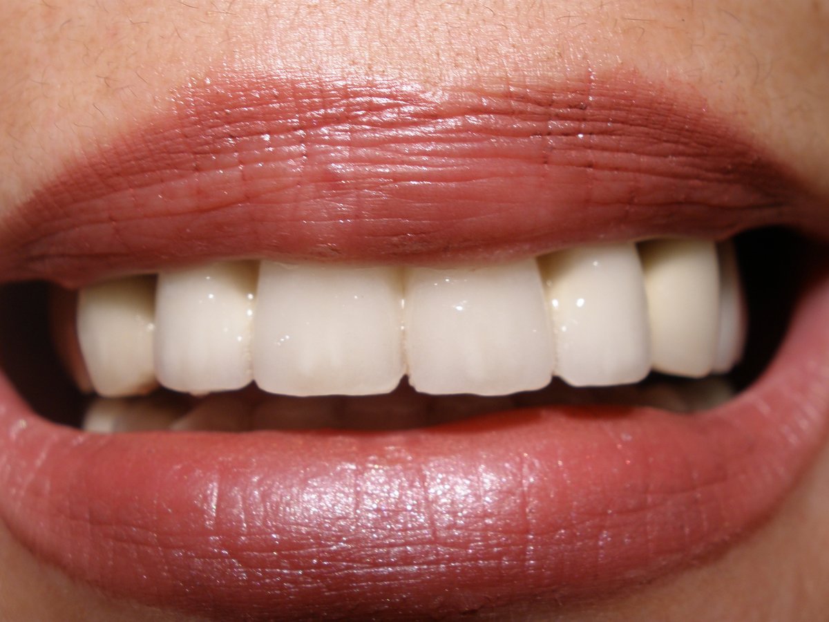 Advanced Dental Clinics Dr.Sacco - Advanced Dental Clinics Dr.Sacco