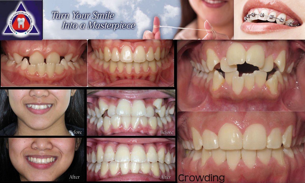 Advanced Multispeciality Dental Centre - Advanced Multispeciality Dental Centre
