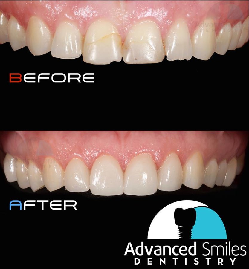 Advanced Smiles Dentistry Tijuana - Advanced Smiles Dentistry Tijuana