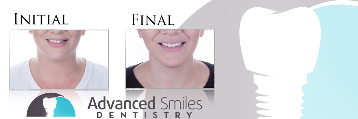 Advanced Smiles Dentistry Tijuana - Advanced Smiles Dentistry Tijuana