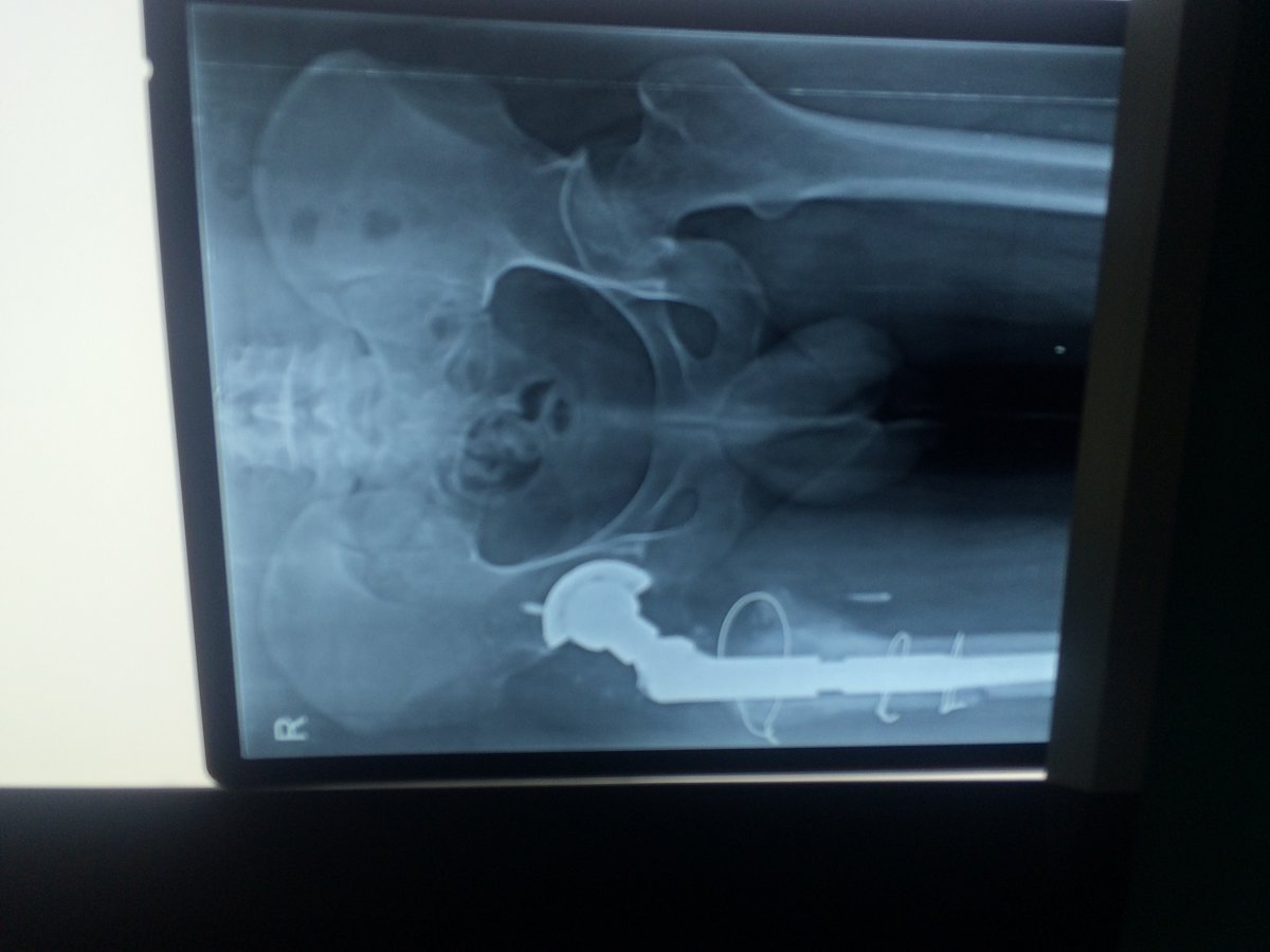 Adyar Ortho Clinic - Adyar Ortho Clinic