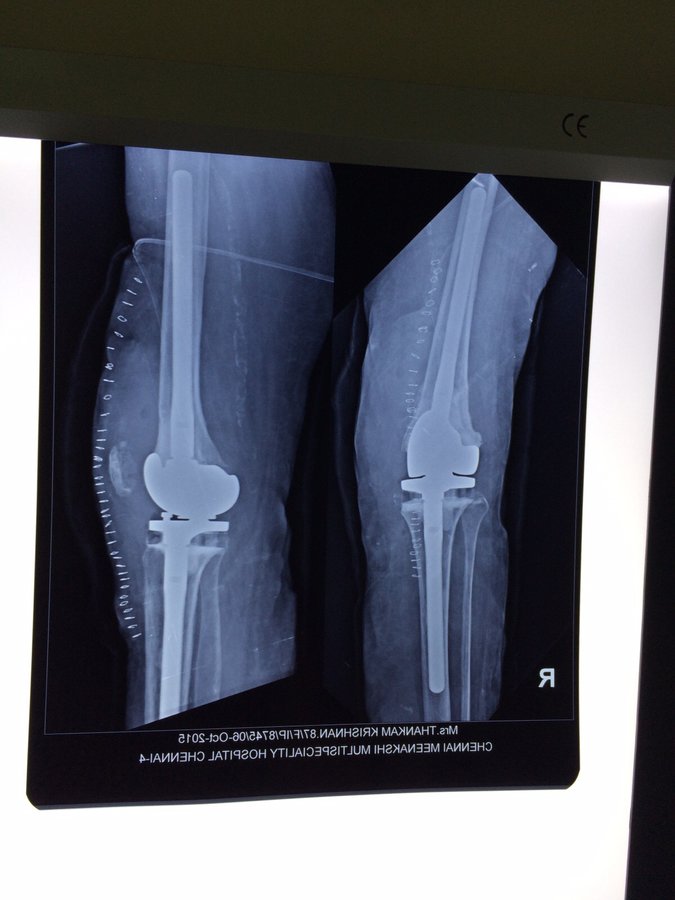 Adyar Ortho Clinic - Adyar Ortho Clinic