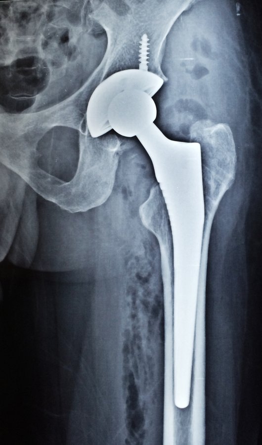 Adyar Ortho Clinic - Adyar Ortho Clinic