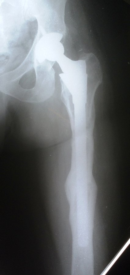 Adyar Ortho Clinic - Adyar Ortho Clinic