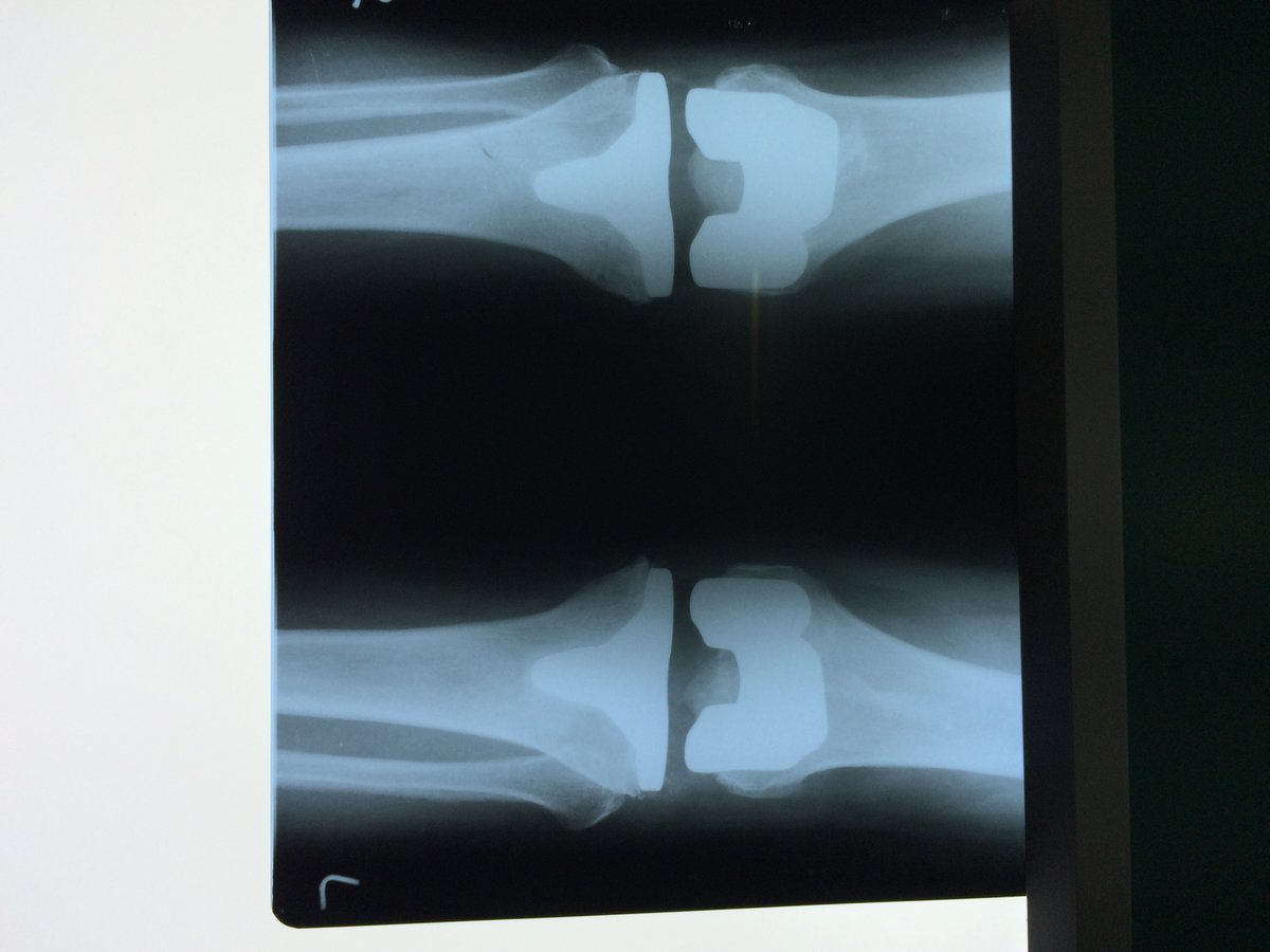 Adyar Ortho Clinic - Adyar Ortho Clinic