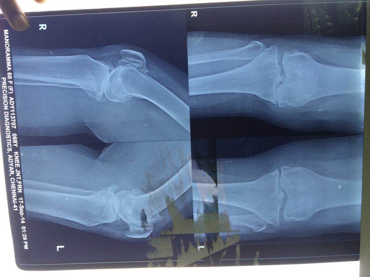 Adyar Ortho Clinic - Adyar Ortho Clinic