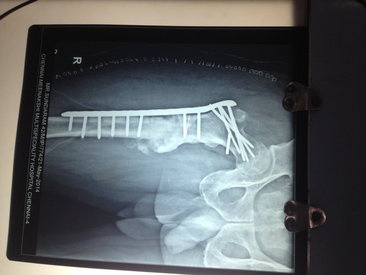 Adyar Ortho Clinic - Adyar Ortho Clinic