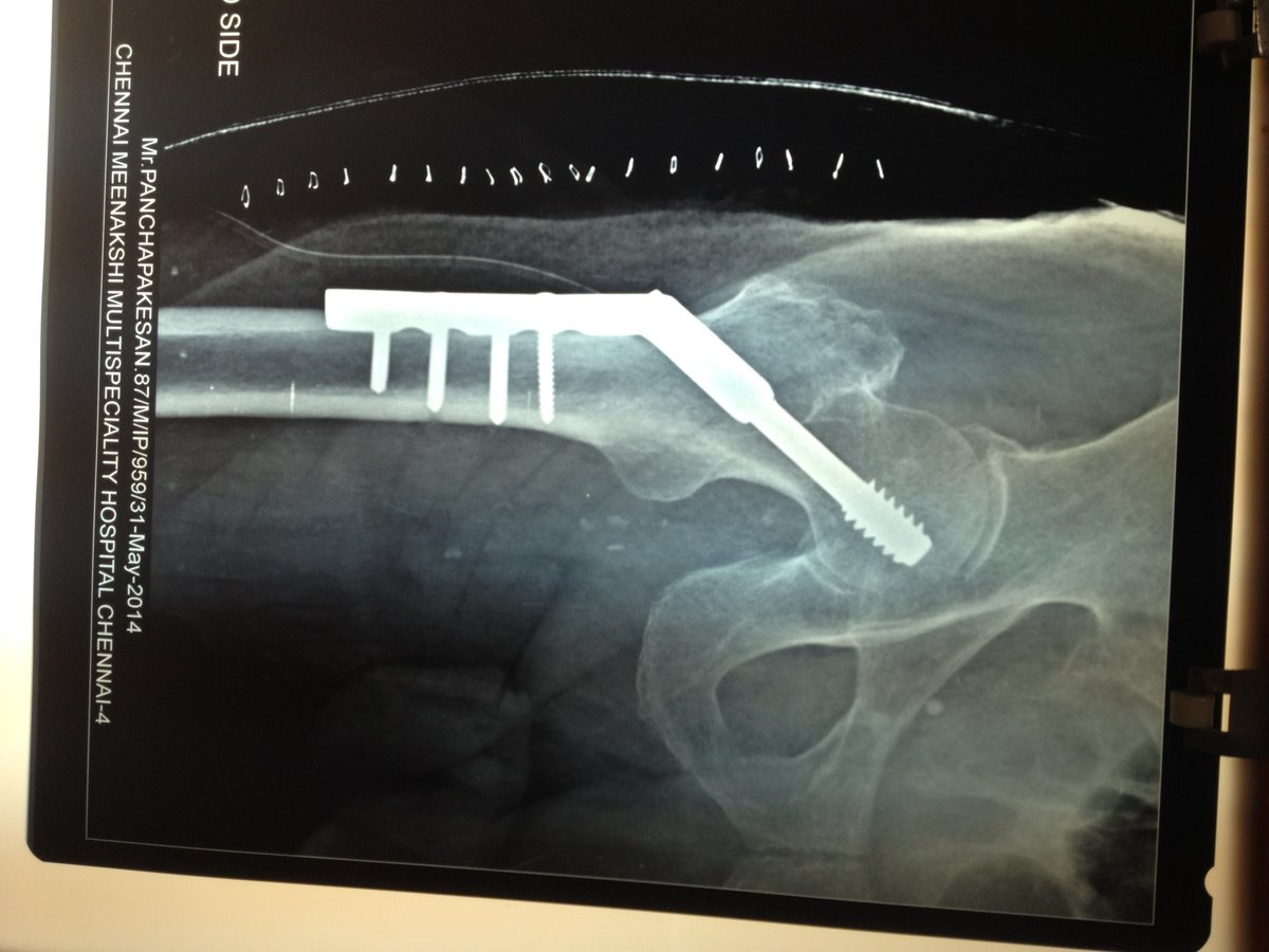 Adyar Ortho Clinic - Adyar Ortho Clinic