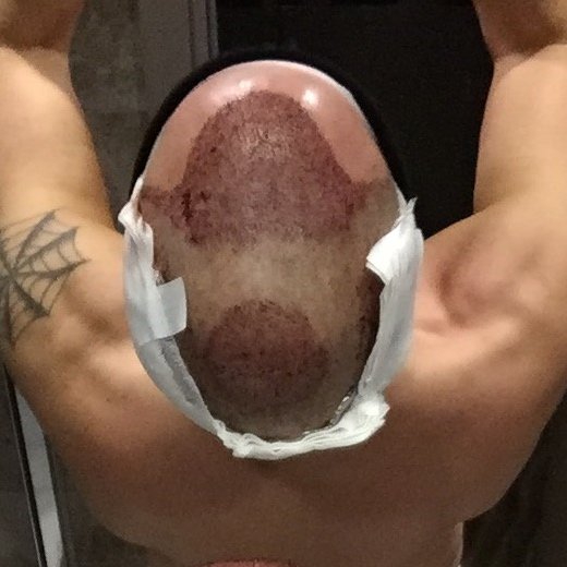 AEK Hair Institute - AEK Hair Institute