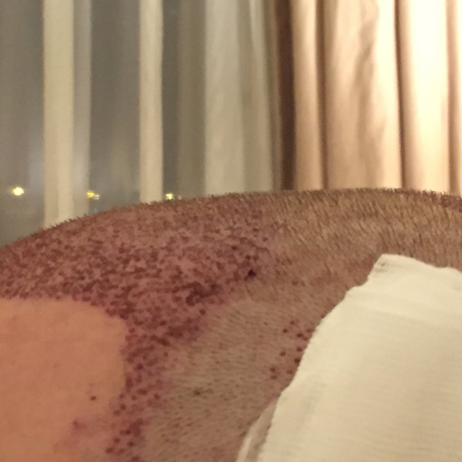 AEK Hair Institute - AEK Hair Institute