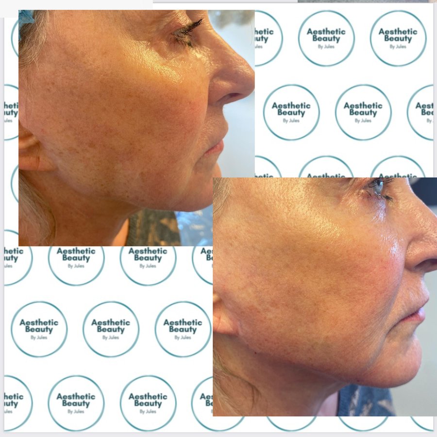 Aesthetic Beauty by Jules - Streetly Village Salon - Aesthetic Beauty by Jules - Streetly Village Salon