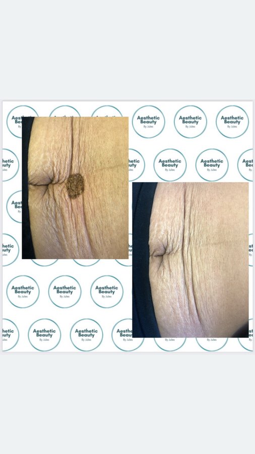 Aesthetic Beauty by Jules - Streetly Village Salon - Aesthetic Beauty by Jules - Streetly Village Salon