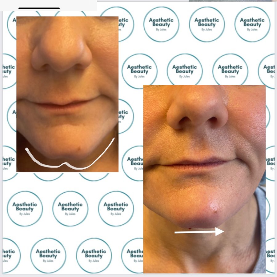 Aesthetic Beauty by Jules - Streetly Village Salon - Aesthetic Beauty by Jules - Streetly Village Salon