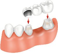 AESTHETIC DENTISTRY - AESTHETIC DENTISTRY