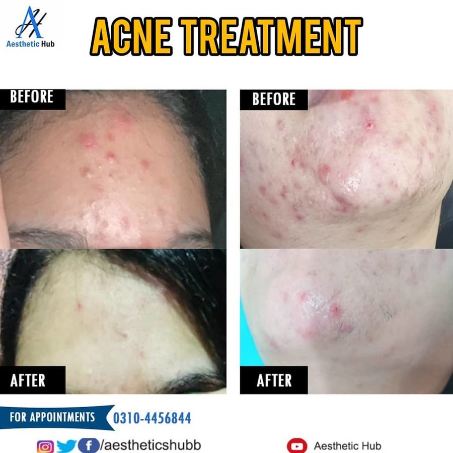 Aesthetic Hub clinic - Aesthetic Hub clinic