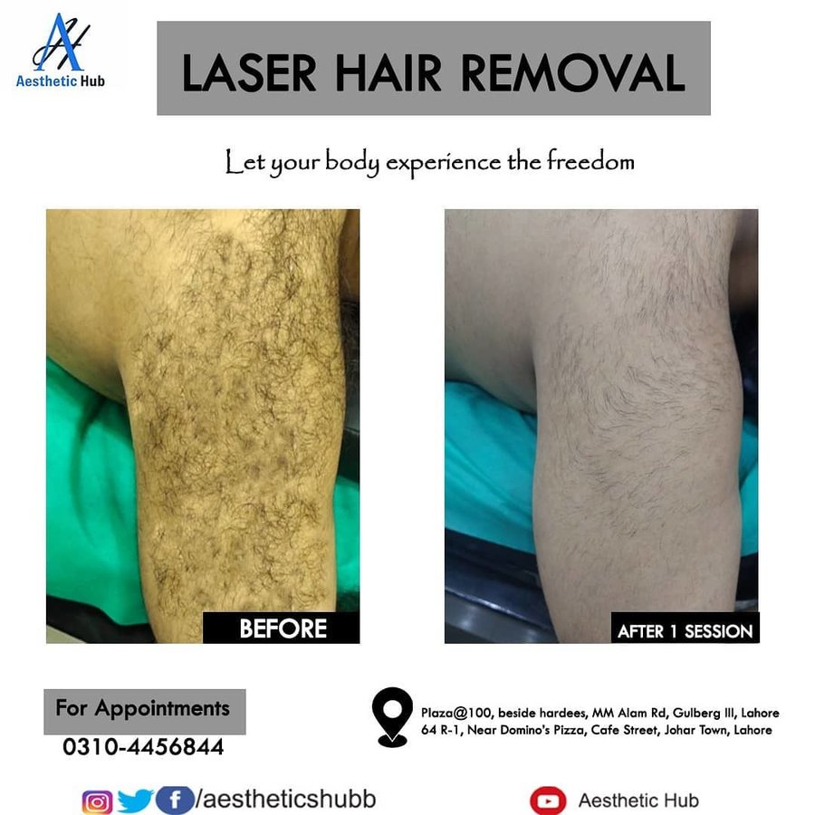 Aesthetic Hub clinic - Aesthetic Hub clinic