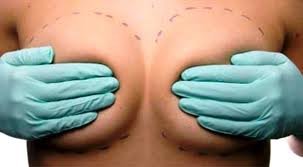 Aesthetic Medical Center Versace Patat - Aesthetic Medical Center Versace Patat