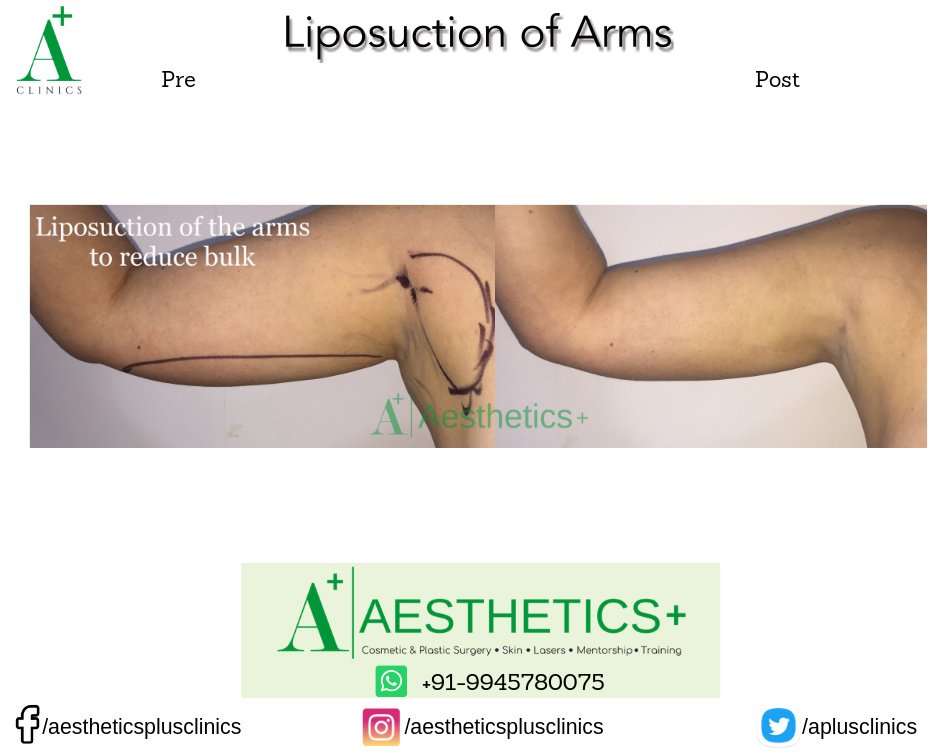 Aesthetic Plus Cosmetic Surgery Clinic - Bangalore Central - Aesthetic Plus Cosmetic Surgery Clinic - Bangalore Central