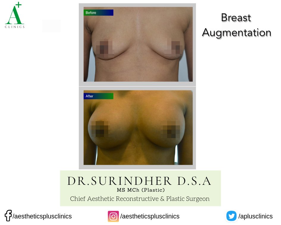 Aesthetic Plus Cosmetic Surgery Clinic - Bangalore Central - Aesthetic Plus Cosmetic Surgery Clinic - Bangalore Central