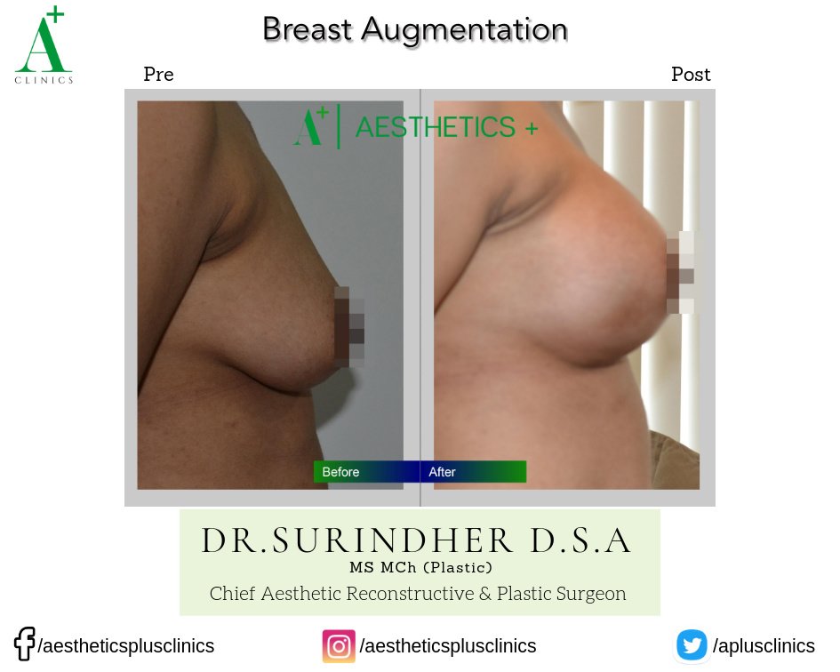 Aesthetic Plus Cosmetic Surgery Clinic - Bangalore Central - Aesthetic Plus Cosmetic Surgery Clinic - Bangalore Central