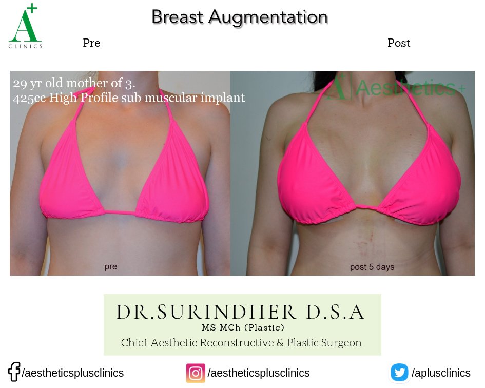 Aesthetic Plus Cosmetic Surgery Clinic - Bangalore Central - Aesthetic Plus Cosmetic Surgery Clinic - Bangalore Central
