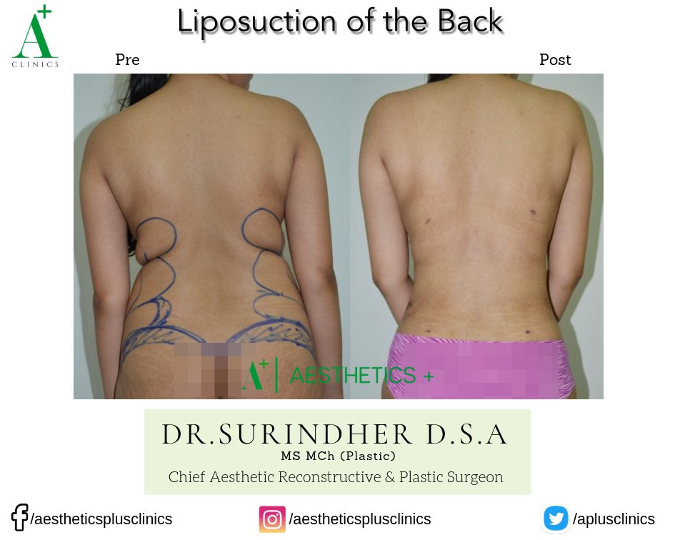 Aesthetic Plus Cosmetic Surgery Clinic - Bangalore Central - Aesthetic Plus Cosmetic Surgery Clinic - Bangalore Central