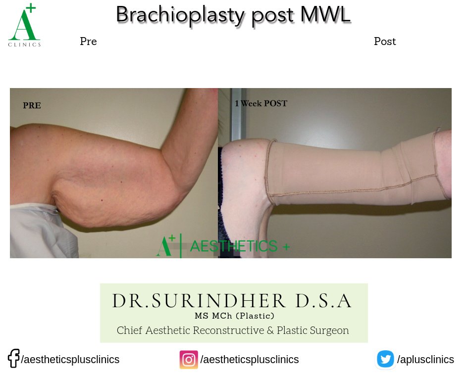 Aesthetic Plus Cosmetic Surgery Clinic - Bangalore Central - Aesthetic Plus Cosmetic Surgery Clinic - Bangalore Central