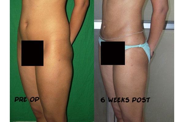 Aesthetic Plus Cosmetic Surgery Clinic - Bangalore Central - Aesthetic Plus Cosmetic Surgery Clinic - Bangalore Central