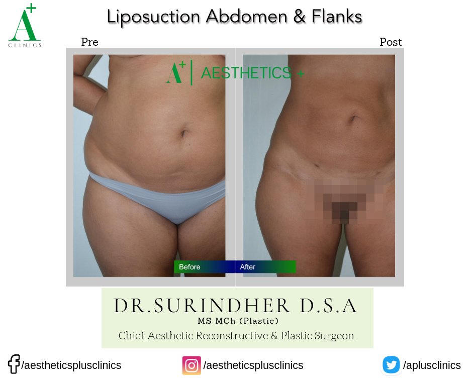 Aesthetic Plus Cosmetic Surgery Clinic - Bangalore Central - Aesthetic Plus Cosmetic Surgery Clinic - Bangalore Central