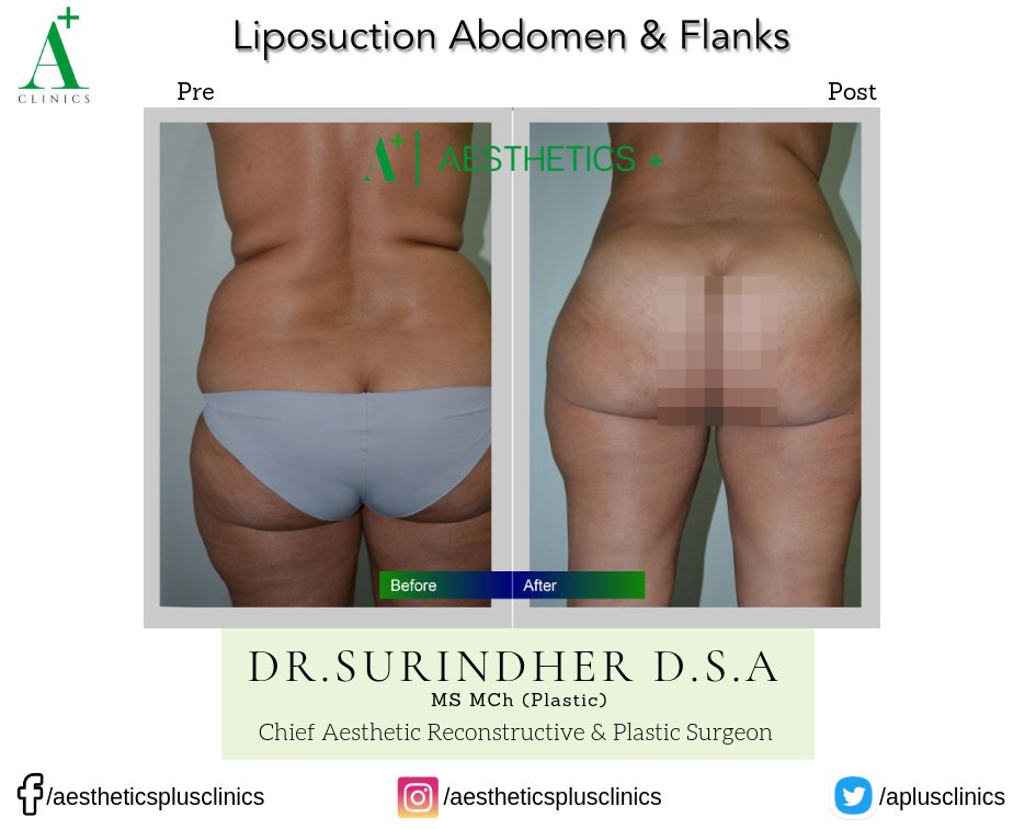 Aesthetic Plus Cosmetic Surgery Clinic - Bangalore Central - Aesthetic Plus Cosmetic Surgery Clinic - Bangalore Central