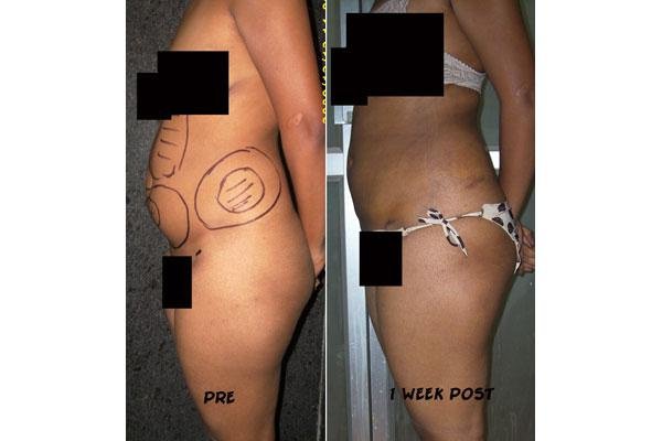 Aesthetic Plus Cosmetic Surgery Clinic - Bangalore Central - Aesthetic Plus Cosmetic Surgery Clinic - Bangalore Central