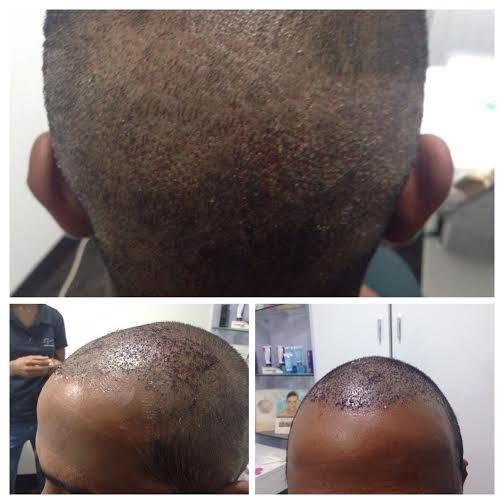 Aesthetic Plus Cosmetic Surgery Clinic - Bangalore Central - Aesthetic Plus Cosmetic Surgery Clinic - Bangalore Central