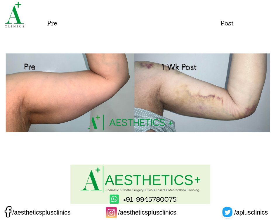 Aesthetic Plus Cosmetic Surgery Clinic - Bangalore Central - Aesthetic Plus Cosmetic Surgery Clinic - Bangalore Central