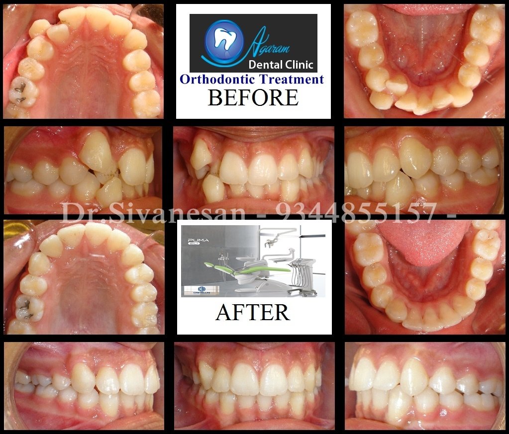 Agaram Dental Clinic - Agaram Dental Clinic