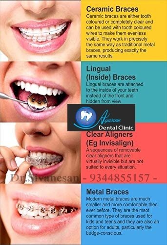 Agaram Dental Clinic - Agaram Dental Clinic